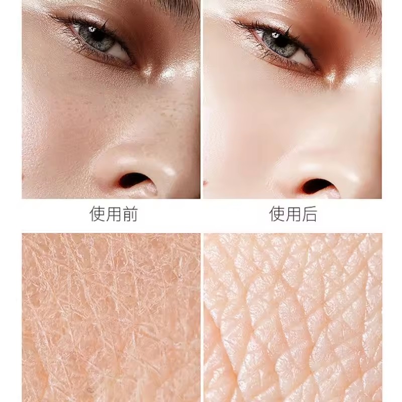 Hyaluronic Acid Niacinamide Ti - đánh giá và giá Niacinamide Pore Shrinking Essence